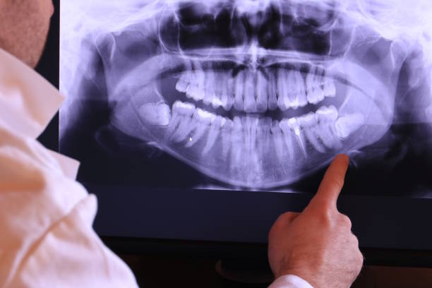Best Emergency Treatment for Toothache in Cloverly, MD