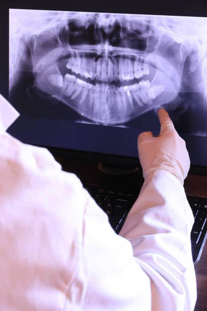 Best Emergency Tooth Extraction in Cloverly, MD