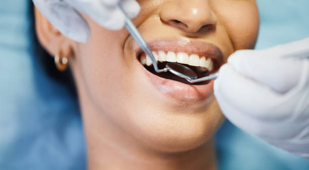 Best Emergency Dental Surgery in Cloverly, MD